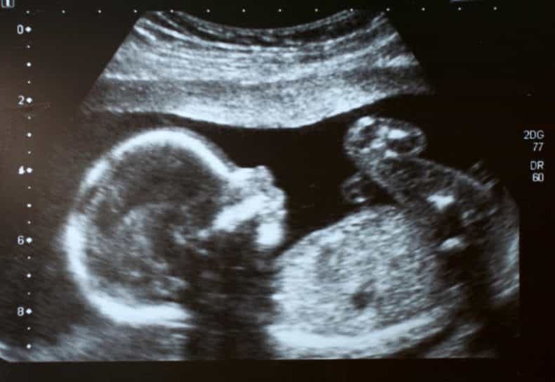 Pregnancy myths: Half of the couples do not know the best ways to conceive
