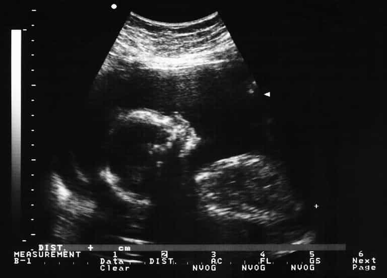 PORTLAOISE: 30 baby deaths to be investigated by the HSE PORTLAOISE: 30 baby deaths to be investigated by the HSE