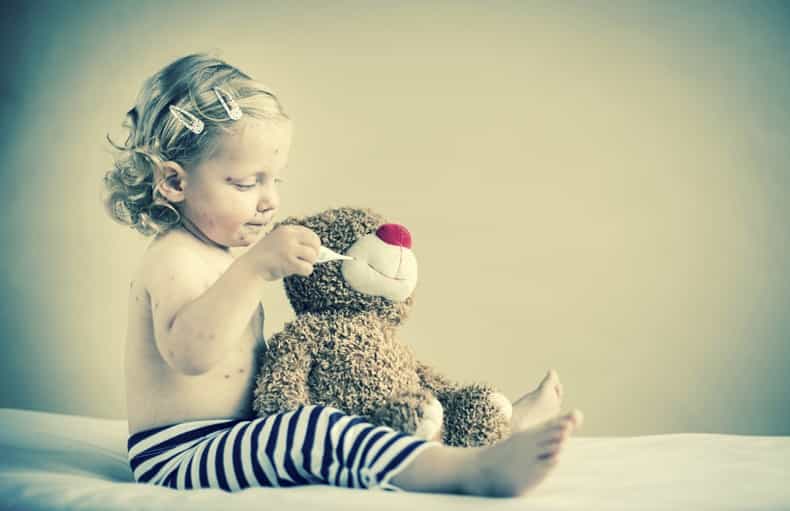 10 times I wanted to run away during chickenpox