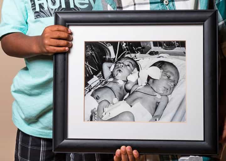 Intimate before-and-after photos of premature babies