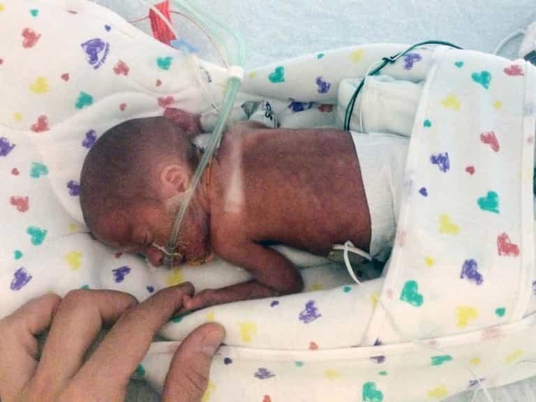 “Miracle baby” born four months early on board a cruise ship survives “Miracle baby” born four months early on board a cruise ship survives