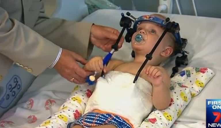Doctors reattach toddler’s head after car crash Doctors reattach toddler’s head after car crash