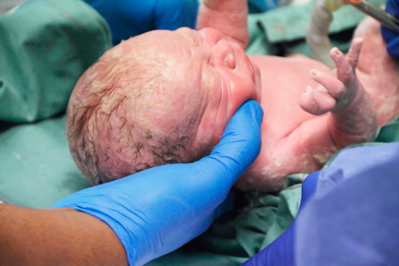 Mother Leaves Placenta Attached To Her Baby For 6 Days