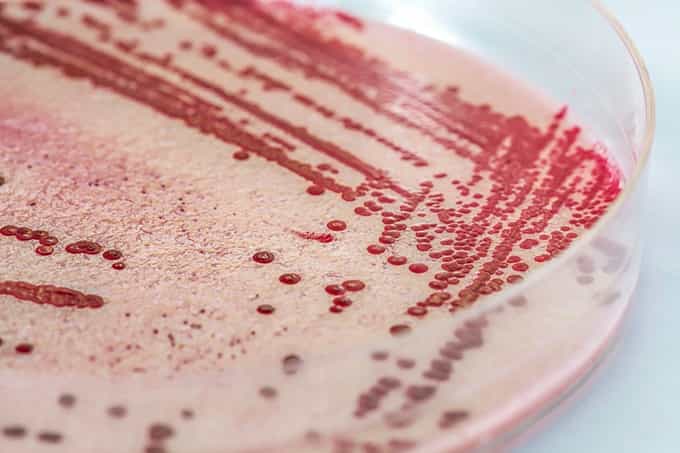 Tesco Recalls Butter Products Over Contamination Fears