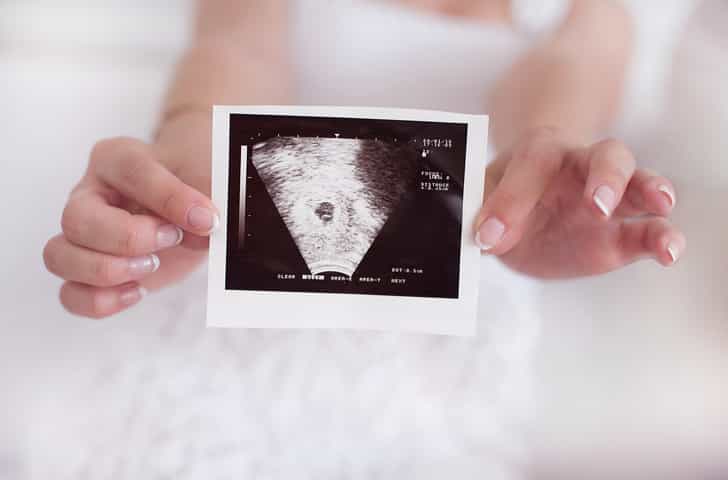 Pregnancy after miscarriage: the whirlwind of fear that comes with those two blue lines