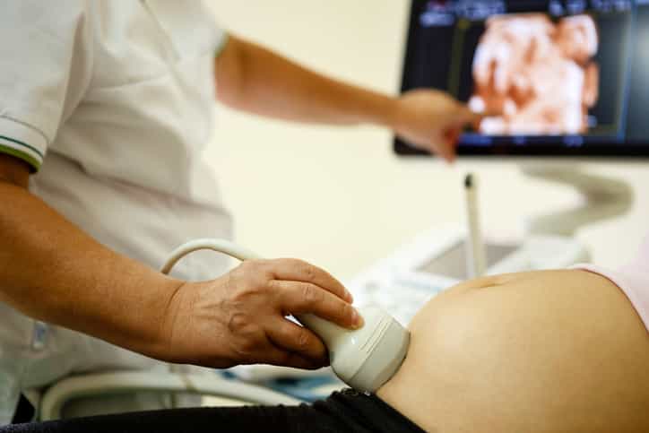 Woman thinks coworker is ‘faking’ pregnancy after noticing something in ultrasound photo Woman thinks coworker is ‘faking’ pregnancy after noticing something in ultrasound photo