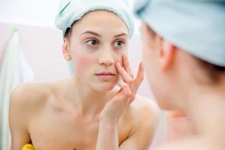 This is one cure for dark circles under your eyes that we can all get behind This is one cure for dark circles under your eyes that we can all get behind