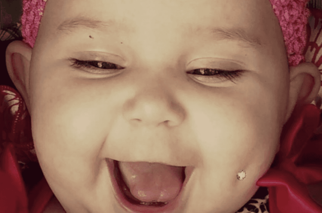 Mum shares photo of her baby’s ‘pierced’ cheek and people have a LOT to say