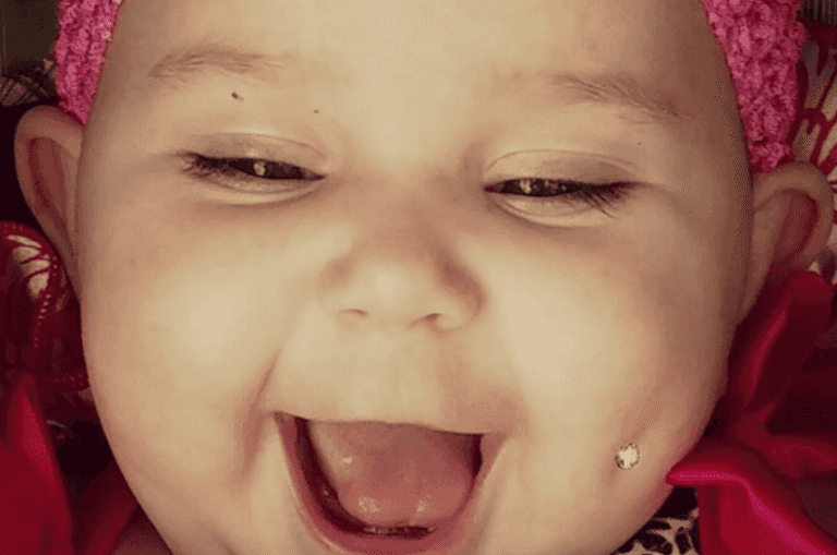 Mum shares photo of her baby’s ‘pierced’ cheek and people have a LOT to say