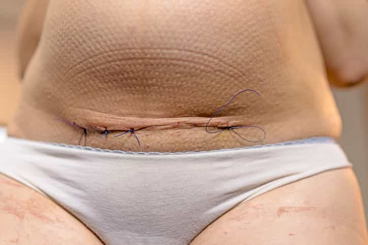 Mum explains why she was ‘too smart to push’ when giving birth