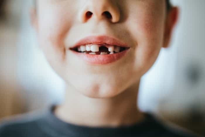 Mum shares photos after toddler accidentally pulls tooth out with tape