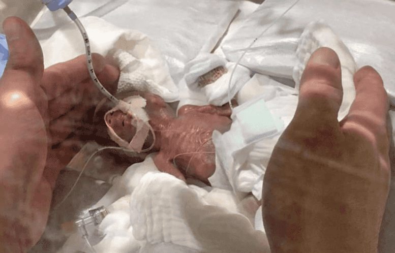 World’s smallest premature baby boy has left hospital healthy