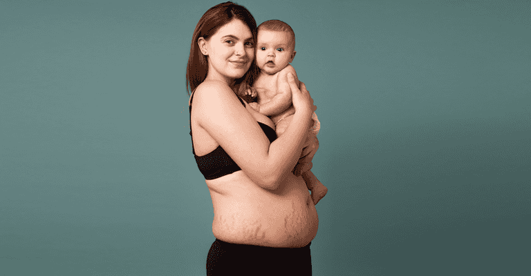 This beautiful ad campaign is showing off mums’ realistic postpartum bodies