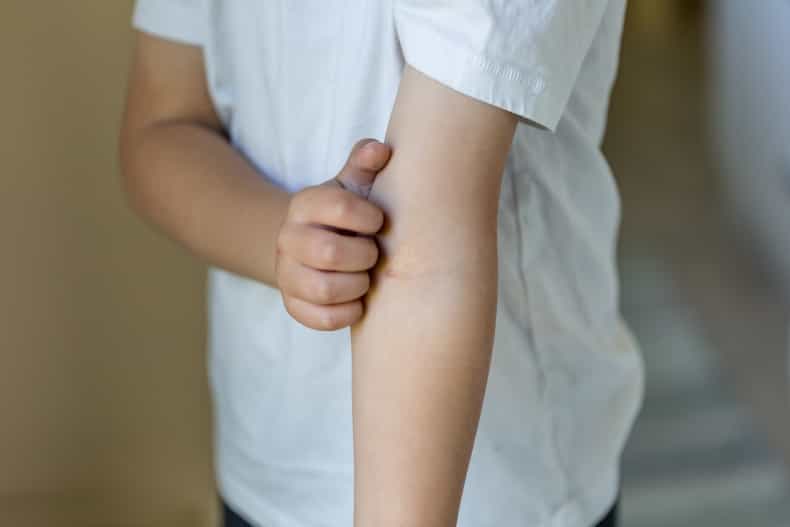 This mum’s post about how she spotted her son’s sepsis has gone viral – and you need to see it