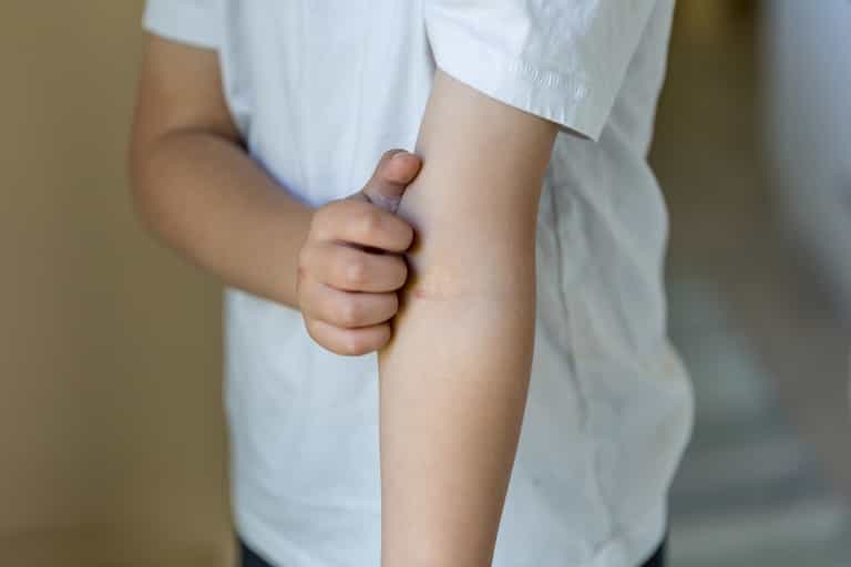 This mum’s post about how she spotted her son’s sepsis has gone viral – and you need to see it