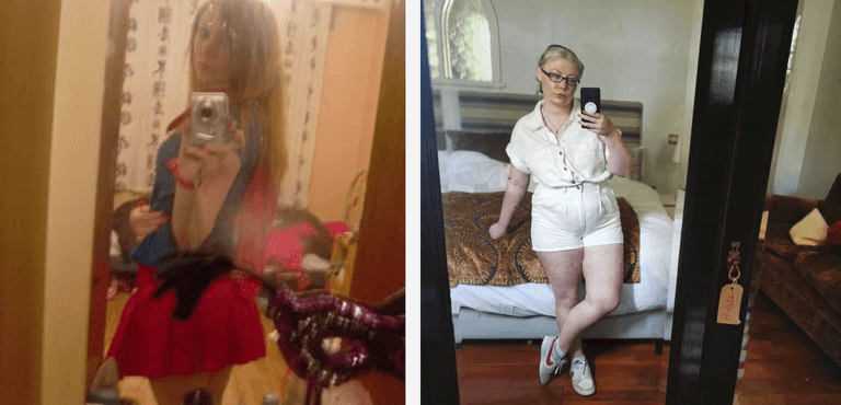 My battle with body dysmorphia stole my teenage years from me