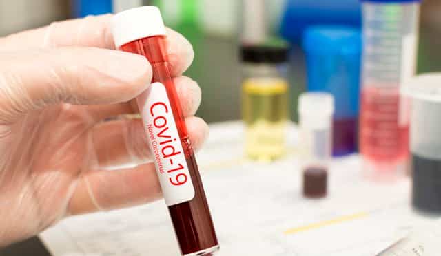 People seeking Covid-19 tests must display two symptoms under new criteria