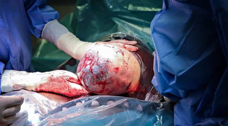 The incredible images of en caul births will never not amaze us The incredible images of en caul births will never not amaze us