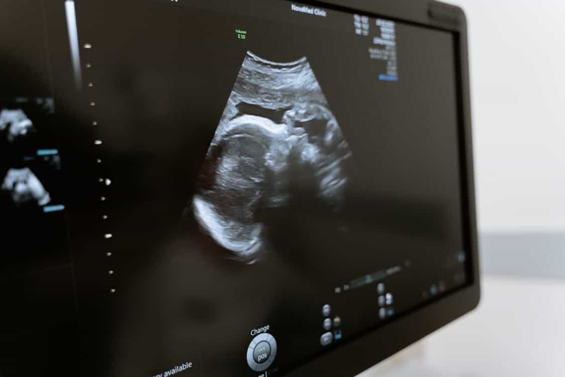 Health: Sims IVF to open satellite clinic in Limerick