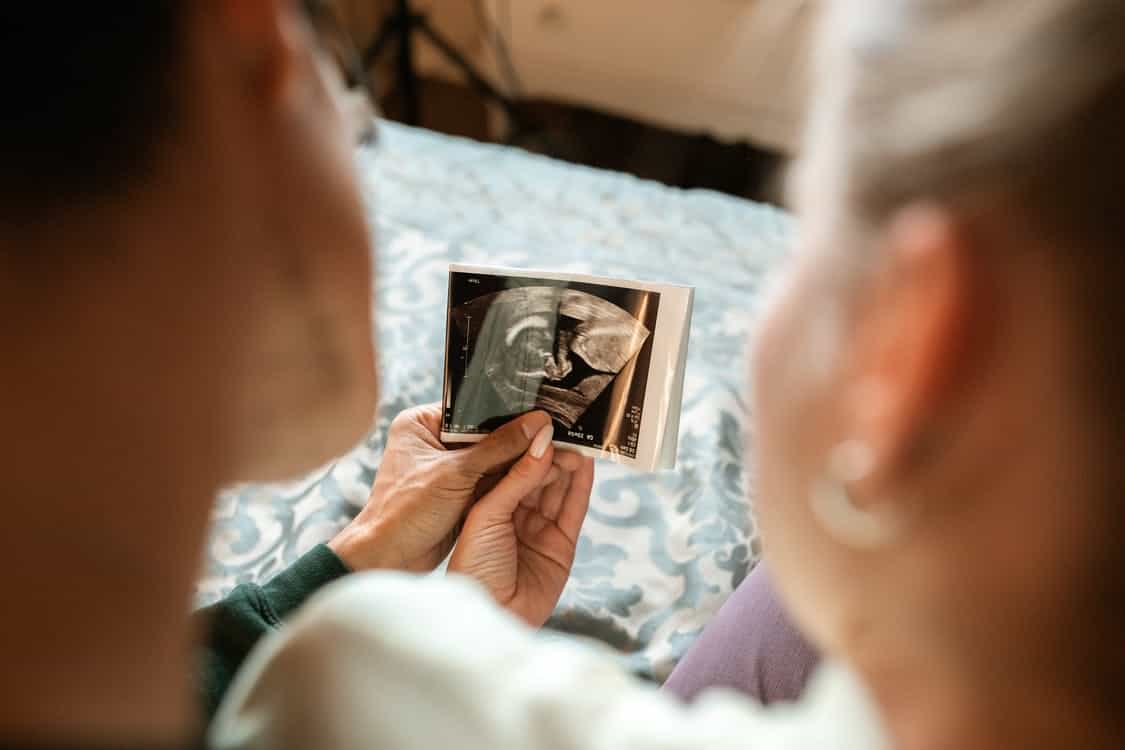 Fertility dietitian explains how diet and exercise can help those with PCOS on fertility journey