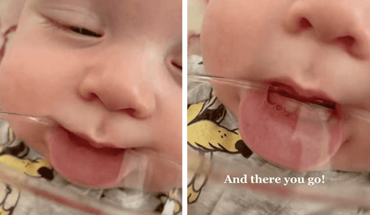 This clever trick makes it easy to know if your baby has started teething