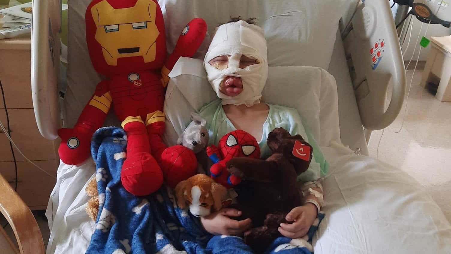 6-year-old boy left “scarred for life” after bullies allegedly set him on fire in US