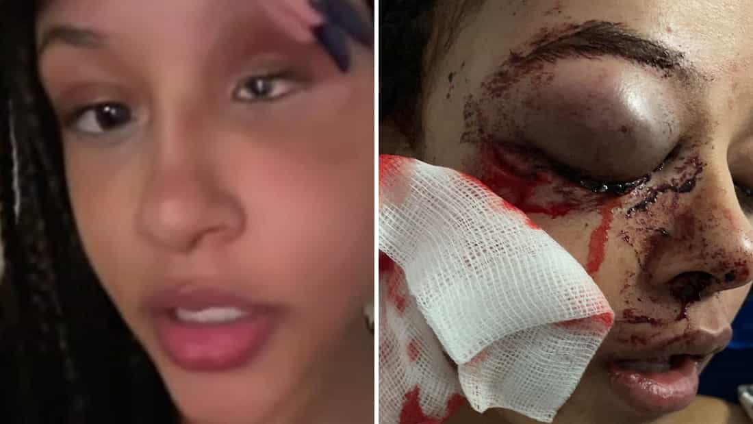 Alanna Quinn Idris shares heartbreaking update after Ballyfermot attack