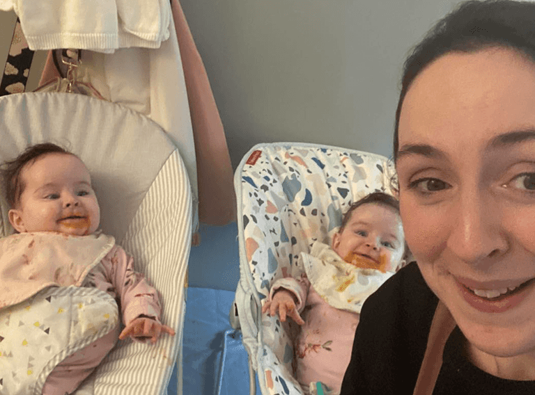 Conjoined twins return to Ireland after successful surgery Conjoined twins return to Ireland after successful surgery