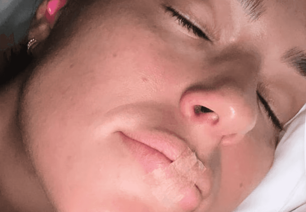 Ashley Graham sleeps with tape over her mouth – but exactly what is taping?