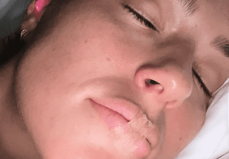 Ashley Graham sleeps with tape over her mouth – but exactly what is taping?