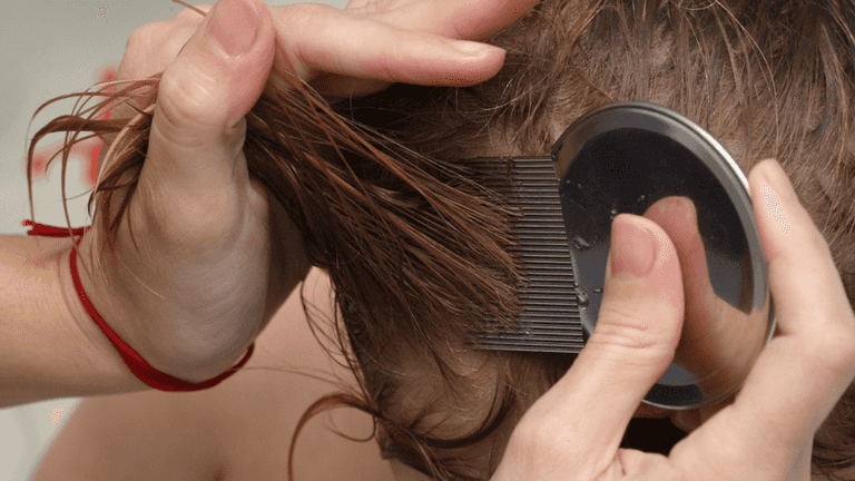 ‘My vegan neighbours won’t remove lice from their child’s hair because it’s cruel’