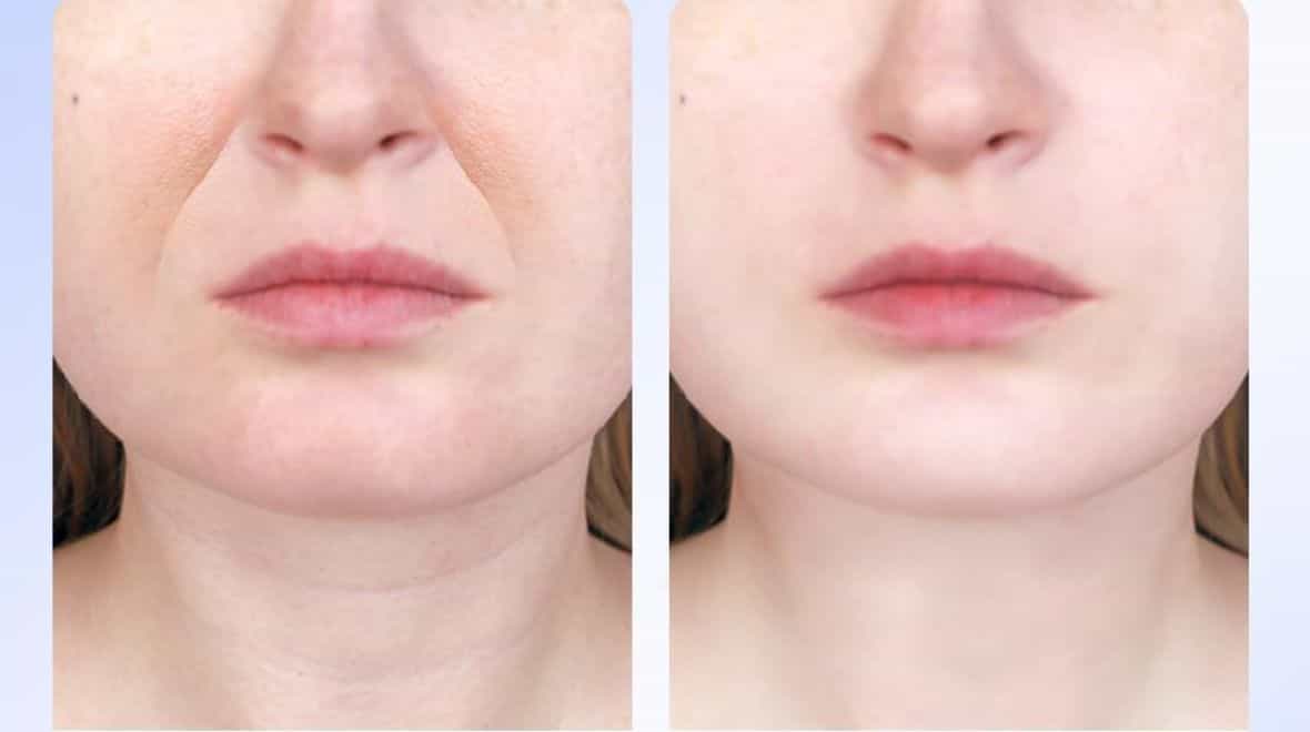 Shoppers ditch anti-ageing creams for €20 gadget designed to tighten skin
