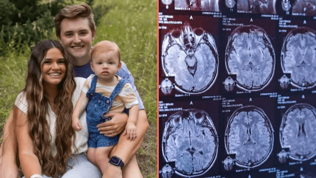 Woman marries man who forgot about their breakup after concussion