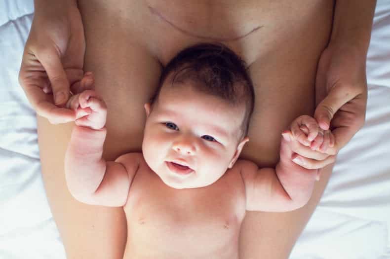“Stop saying that C-sections are the easy way out!” – a mother’s plea