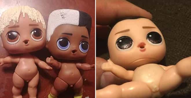 Some parents were disturbed to discover that LOL Surprise Dolls have genitals Some parents were disturbed to discover that LOL Surprise Dolls have genitals