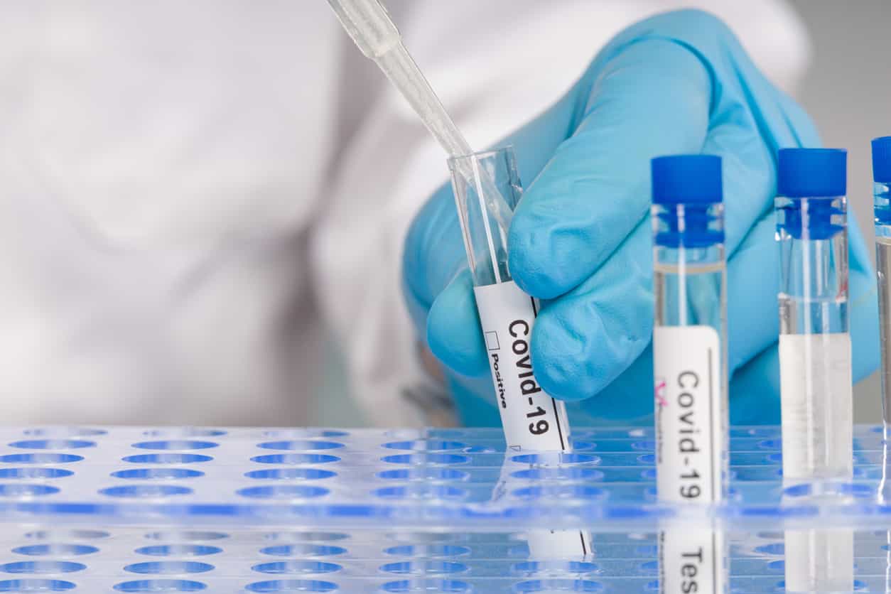 A 22-month-old has been tested for Covid 74 times since he was born