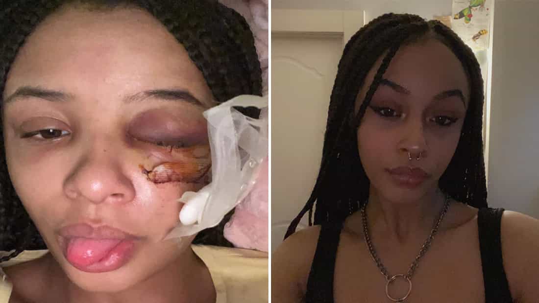 Mother of Alanna Quinn Idris reveals people keep staring at her daughter