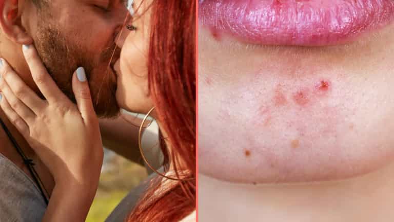 Expert issues grim warning to anyone who kisses bearded men Expert issues grim warning to anyone who kisses bearded men