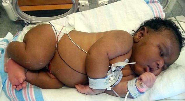 Whoa Baby! Florida woman gives birth to 14lb son