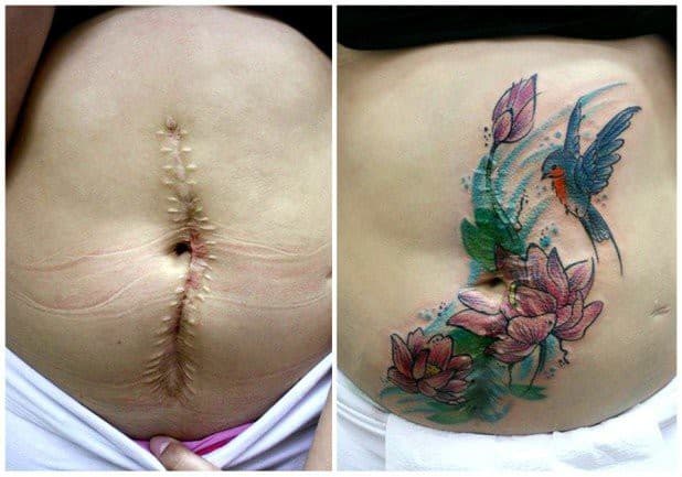 PICS: This tattoo artist turns 6 women’s scarred bodies into artworks PICS: This tattoo artist turns 6 women’s scarred bodies into artworks