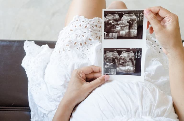 More women are revealing they are pregnant in 1st trimester and why I wish I had too More women are revealing they are pregnant in 1st trimester and why I wish I had too