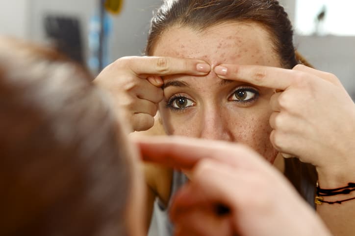 So here’s the reason behind breakouts on each part of your face So here’s the reason behind breakouts on each part of your face