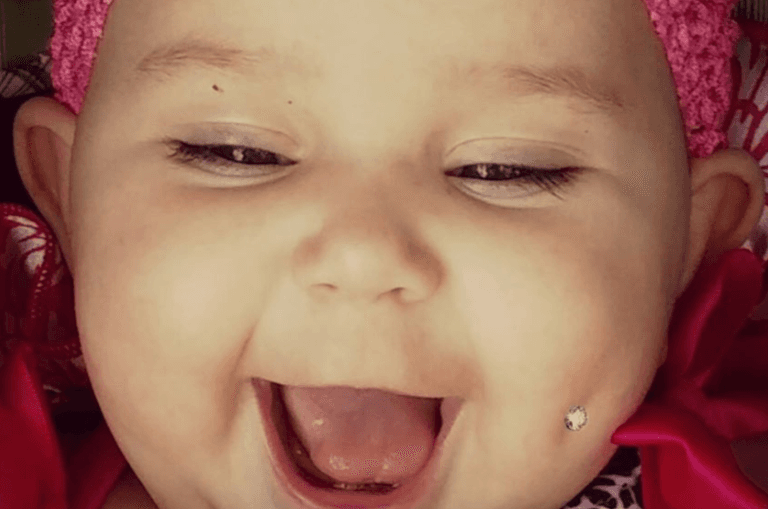 Mum shares photo of her baby’s ‘pierced’ cheek and people have a LOT to say