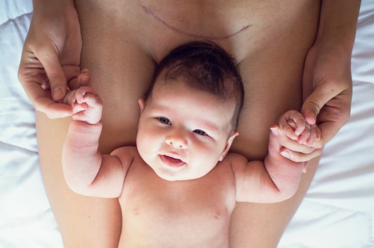 This mum has invented special underwear to help with C-section recovery