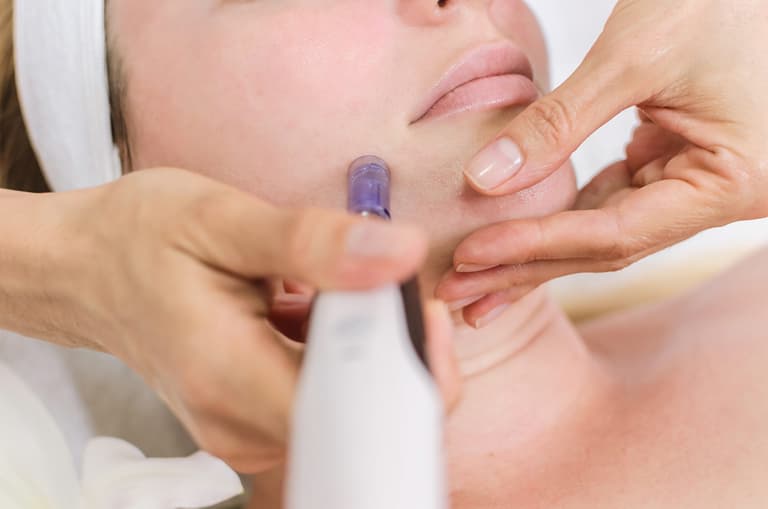 I tried Nano-Needling for the first time and it left my face absolutely glowing