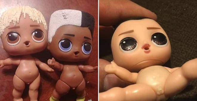 Some parents were disturbed to discover that LOL Surprise Dolls have genitals Some parents were disturbed to discover that LOL Surprise Dolls have genitals