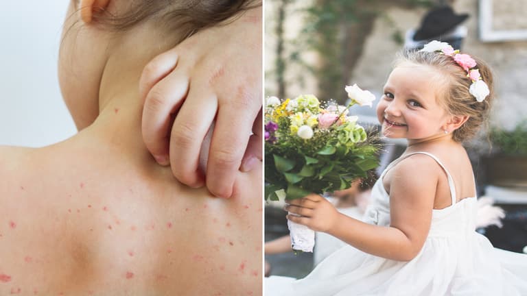 Bride asks to remove niece as flower girl “because of how she looks”