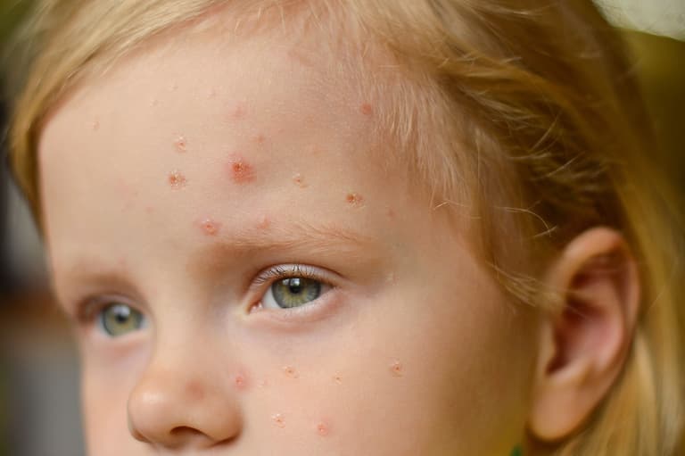 16 people have died from invasive Strep A since October, HSE confirms