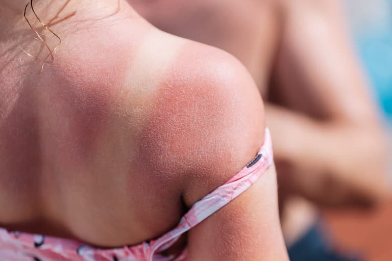 Stock up on suncream – Met Éireann says heat wave is here to stay as charity warns of sunburn