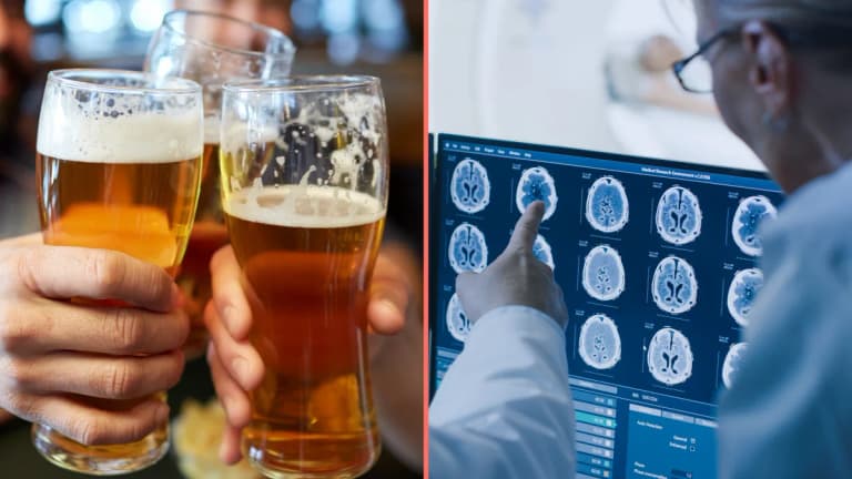 Expert reveals the exact age you should quit drinking to prevent Alzheimer’s Expert reveals the exact age you should quit drinking to prevent Alzheimer’s